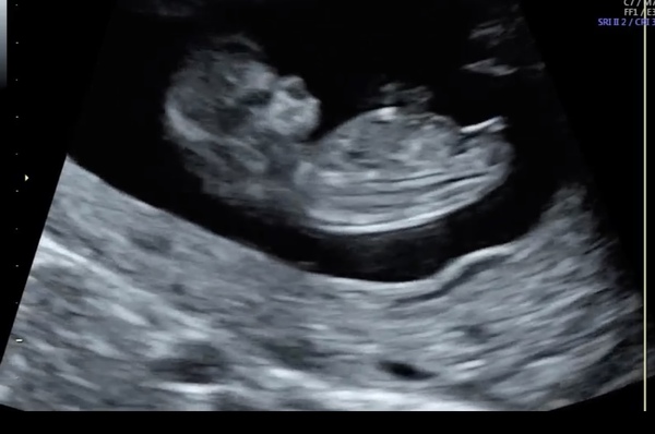 Do you want me to guess the sex? 12 week scans.