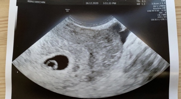 3x Due Aug 21 consolidated