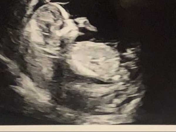 Do you want me to guess the sex? 12 week scans.