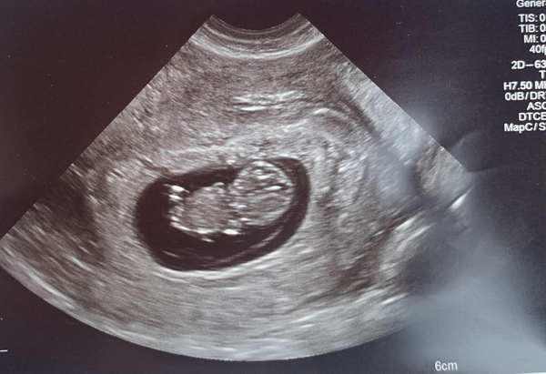 4 weeks today!