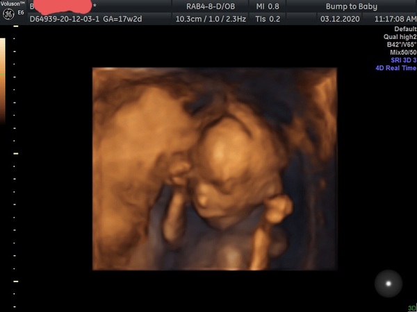 Scottish Mamas Due March - July 2021