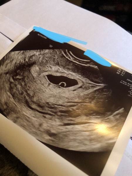 Can someone help date my pregnancy please!