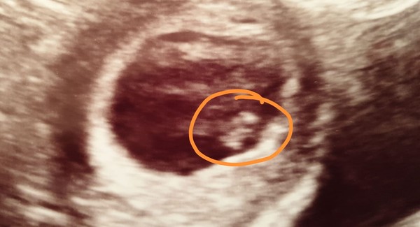 Pre-conception, planning and trying!