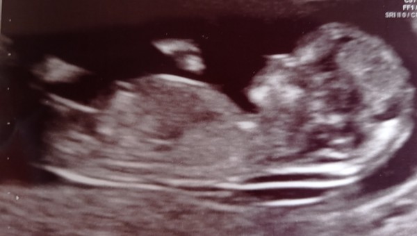 Do you want me to guess the sex? 12 week scans.