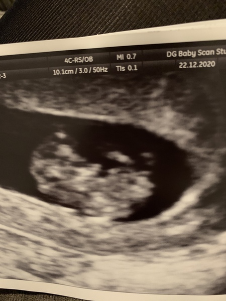 Gender predictions?