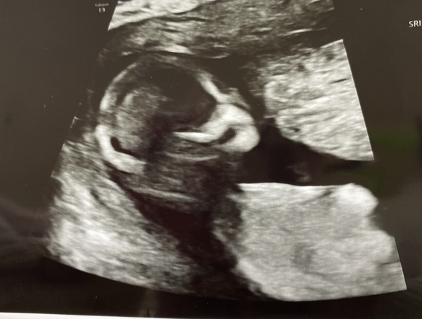 Another gender guess one!