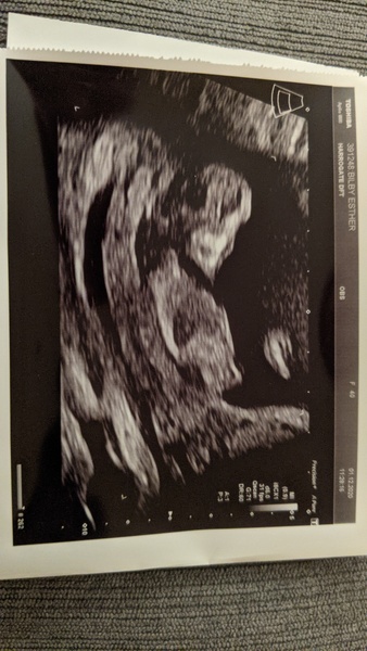 Any gender guesses - not a great pic!