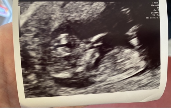 Do you want me to guess the sex? 12 week scans.