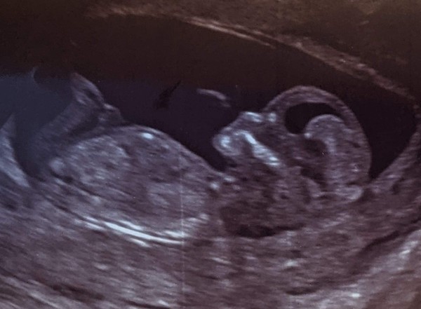 Do you want me to guess the sex? 12 week scans.
