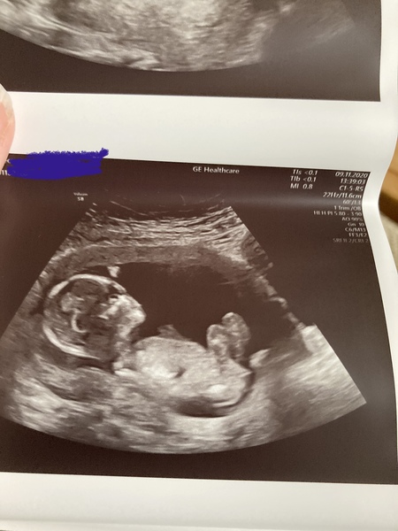 Do you want me to guess the sex? 12 week scans.