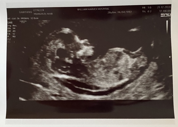 Do you want me to guess the sex? 12 week scans.
