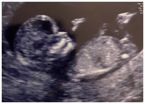 Do you want me to guess the sex? 12 week scans.