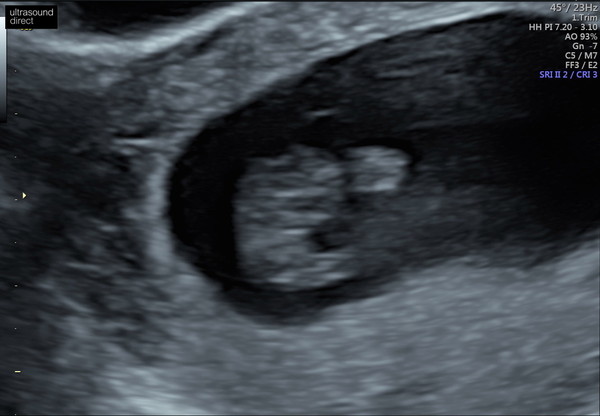 4 weeks today!