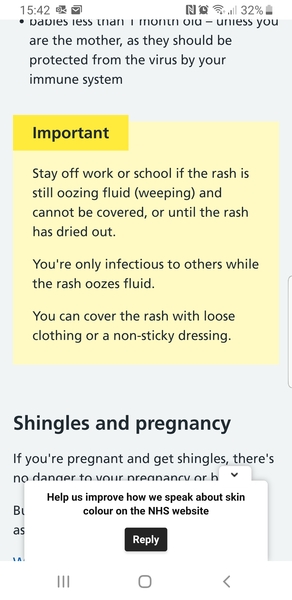 Could dc have caught chickenpox from mil?