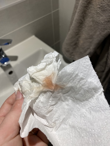 TMI- what is this?! Help!