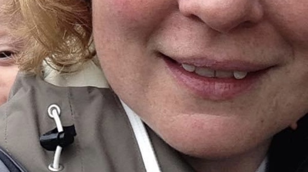 To ask if you have used invisalign? (Or similar aligners?)