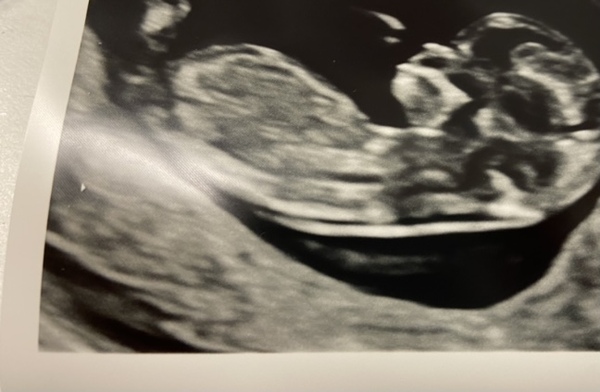 Do you want me to guess the sex? 12 week scans.