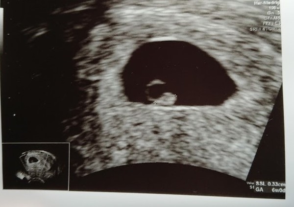 3x Due Aug 21 consolidated