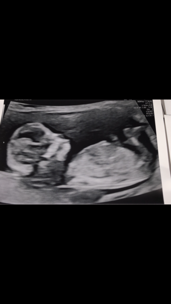 Boy or girl?