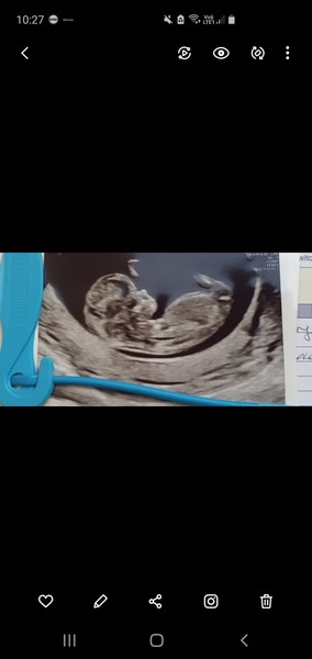 12 week scan guesses