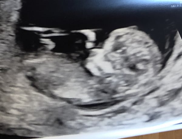 Boy or girl?