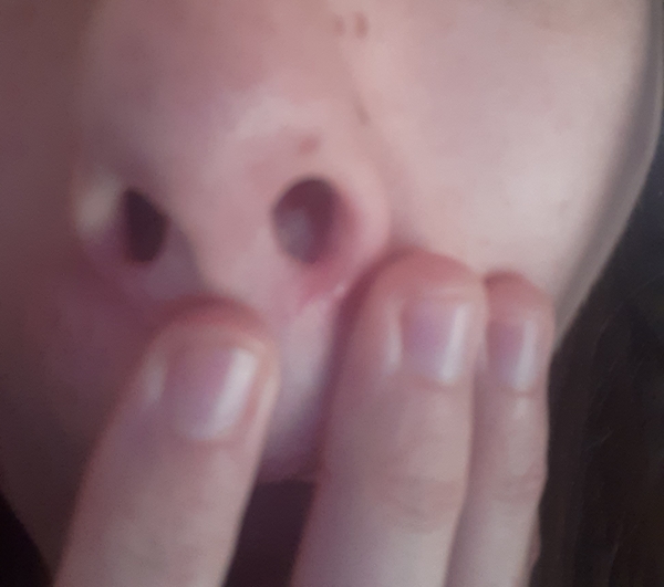 Weird Lump - please help
