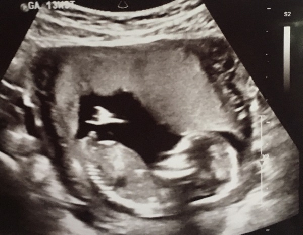 Gender guess pls help