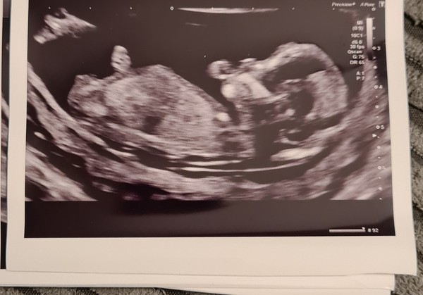 Do you want me to guess the sex? 12 week scans.