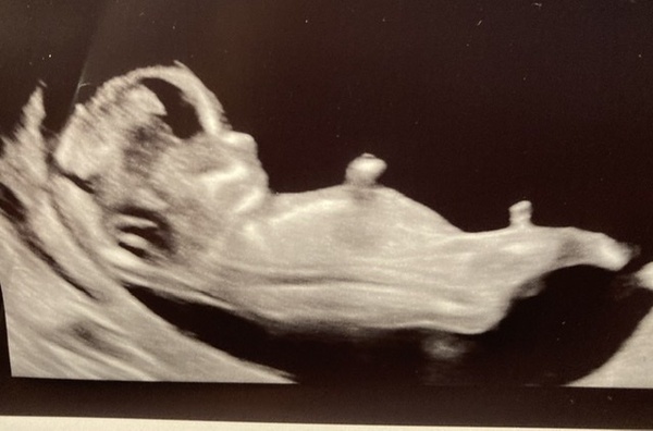 Do you want me to guess the sex? 12 week scans.
