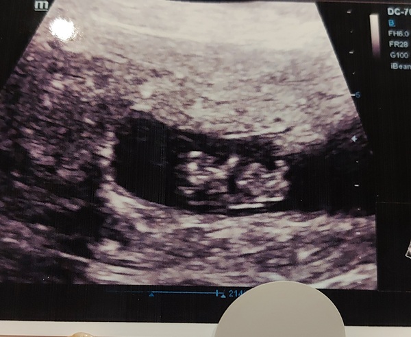 July/August 2021! Second babies