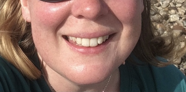 To ask if you have used invisalign? (Or similar aligners?)