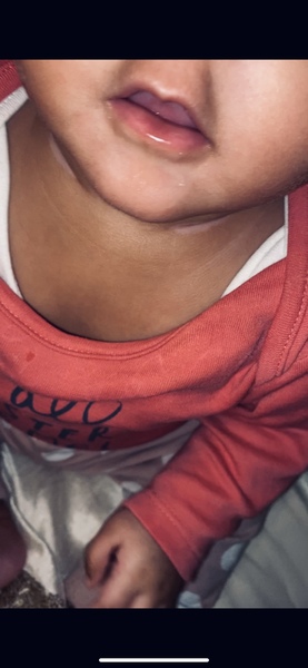 ***HELP*** Baby lips turn darker on and off