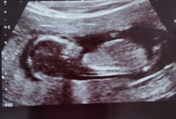 13 weeks - Any guesses?