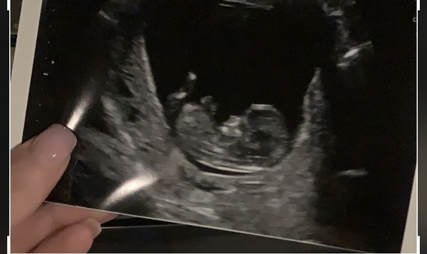 11+3 scan any guesses?