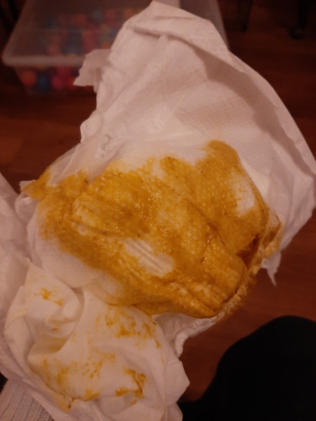 Does this nappy look normal to you? Warning pic!
