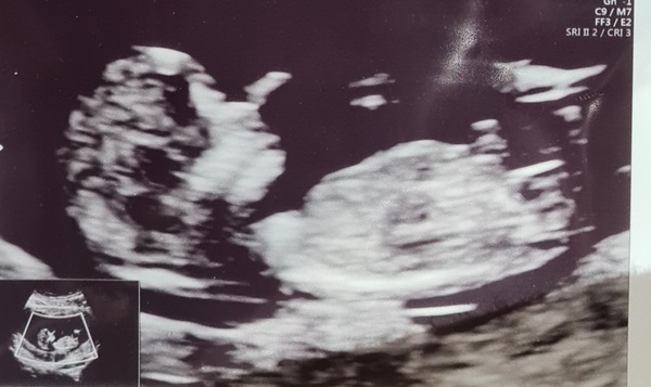 Do you want me to guess the sex? 12 week scans.