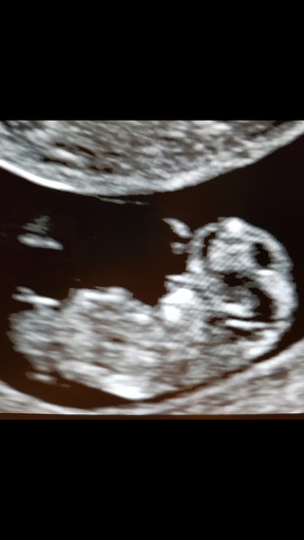 Do you want me to guess the sex? 12 week scans.