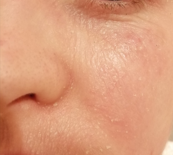 Please recommend something for my face