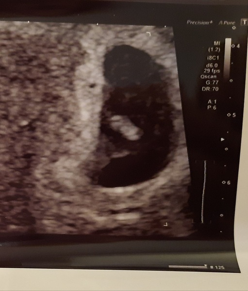 3x Due Aug 21 consolidated