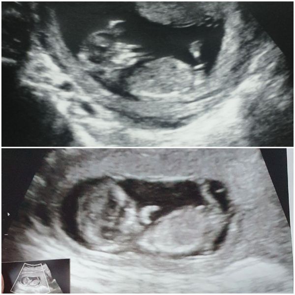 Do you want me to guess the sex? 12 week scans.