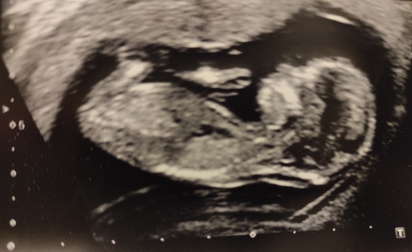 June 2021 part 3!