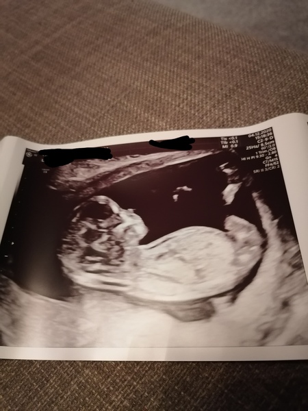 Boy or girl?