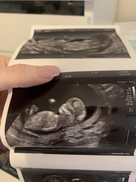 Just for fun 12+4 boy / girl guesses