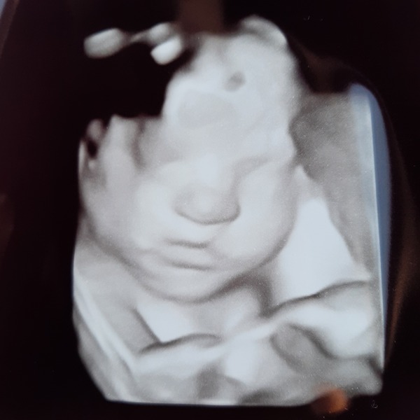 Pregnant after miscarriage part 4, TTC graduates