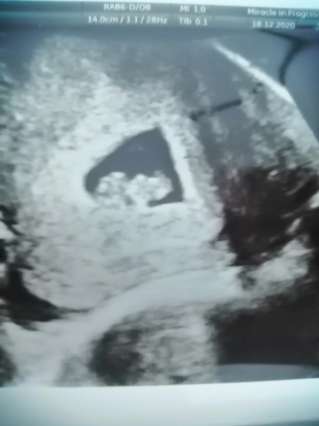 4 weeks today!