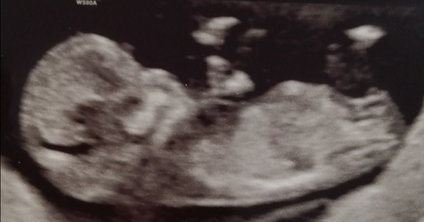 Do you want me to guess the sex? 12 week scans.