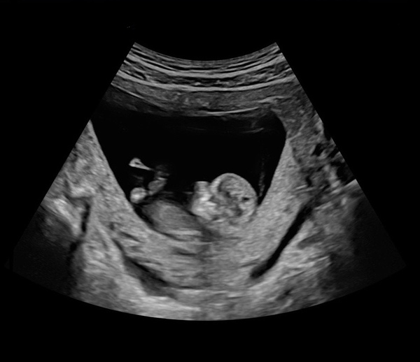 July 2021 2