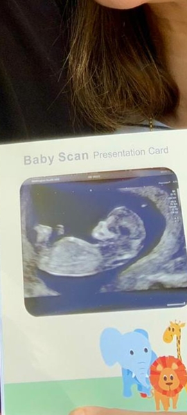 Boy or girl...can anyone guess from this scan?