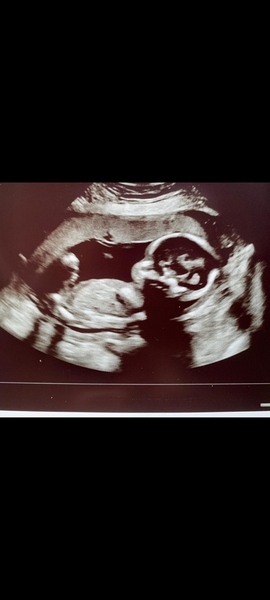 Boy or girl...can anyone guess from this scan?