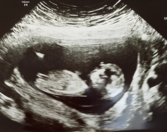 Do you want me to guess the sex? 12 week scans.
